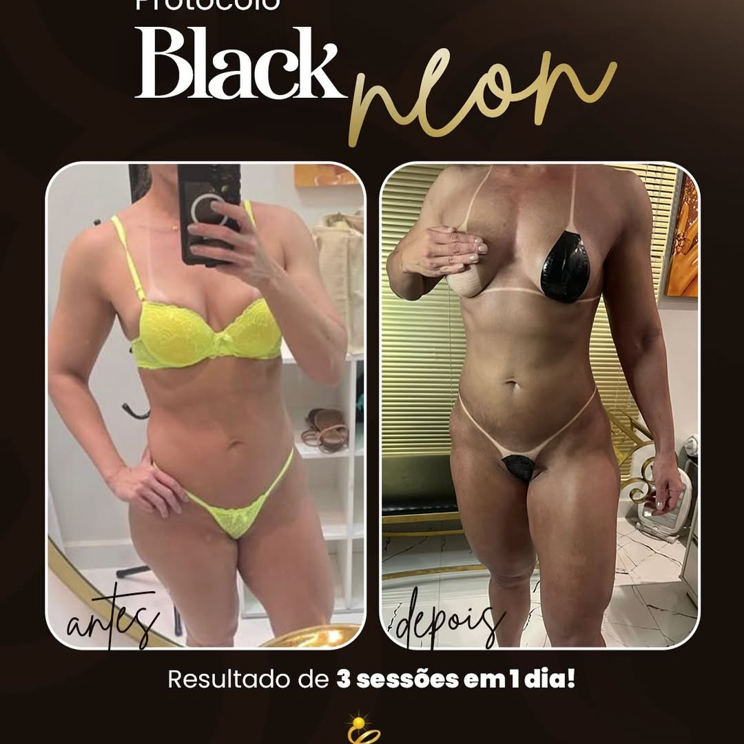 Protocolo Black Neon-saia bronzeada de verdade