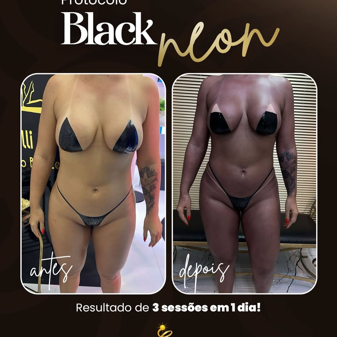 Resultado Black Neon-em 3 sessões