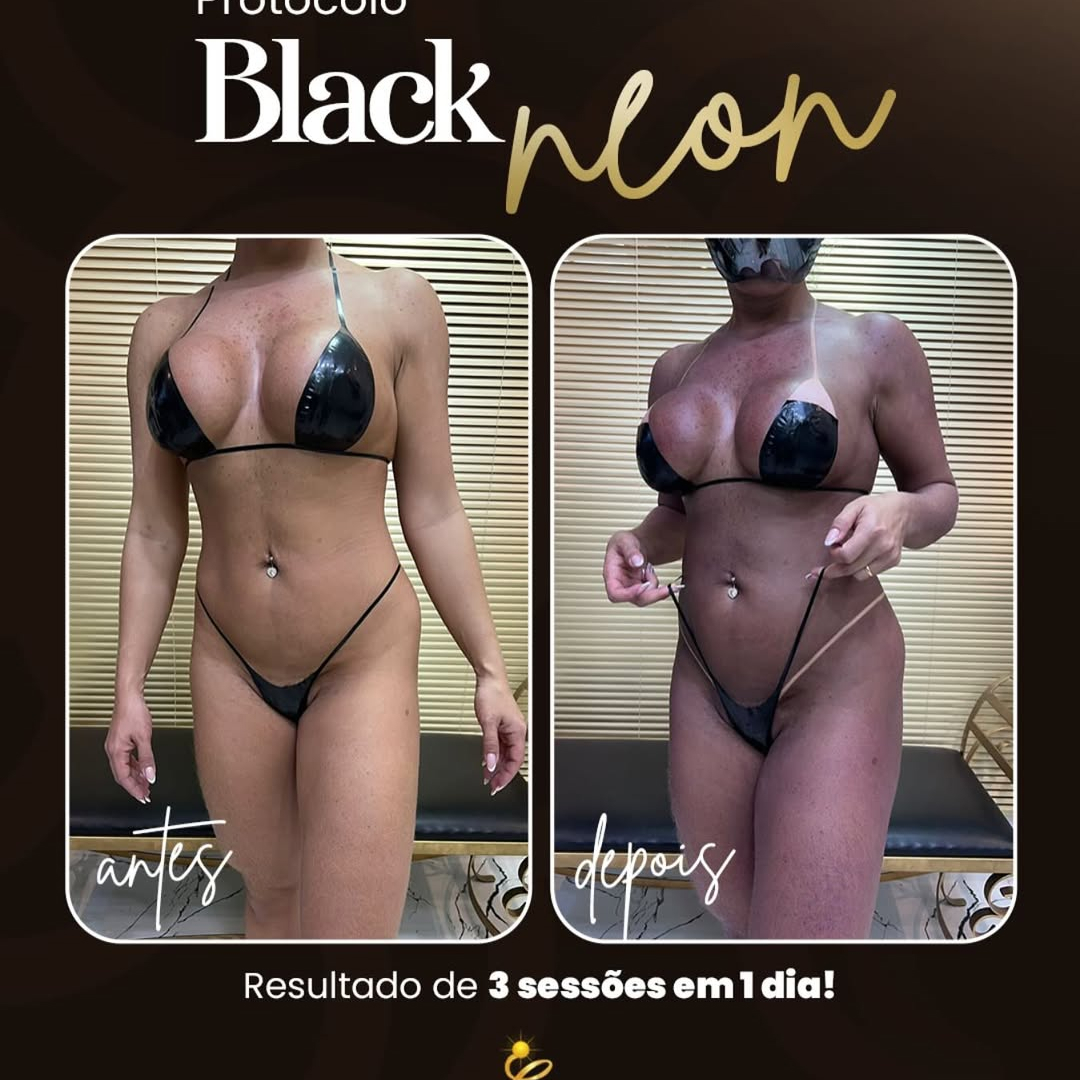 Resultado bronze neon-confira !