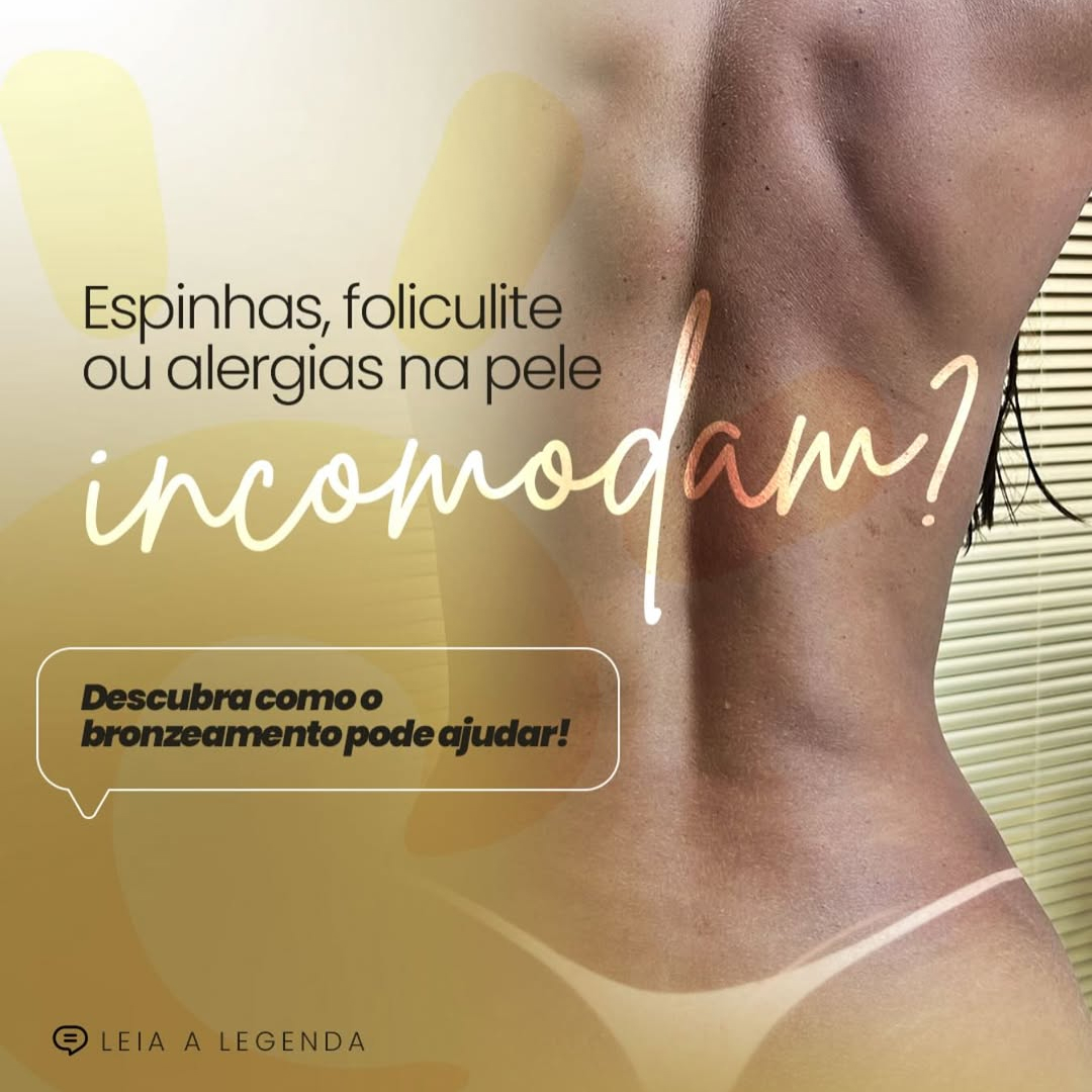 Mais que uma marquinha perfeita-é Copelli Bronze